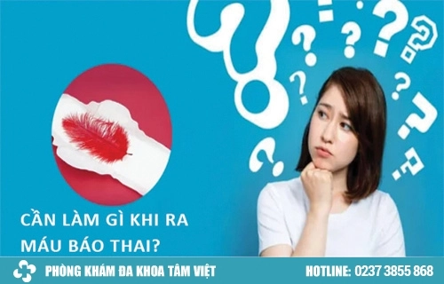 giải đáp thắc mắc về kinh nguyệt dính nệm