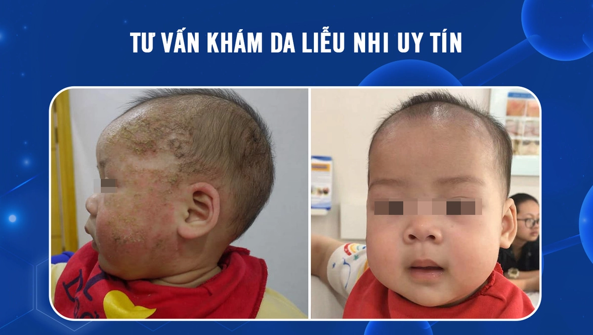 chuyên gia nhi khoa tư vấn Graco và Babymoov