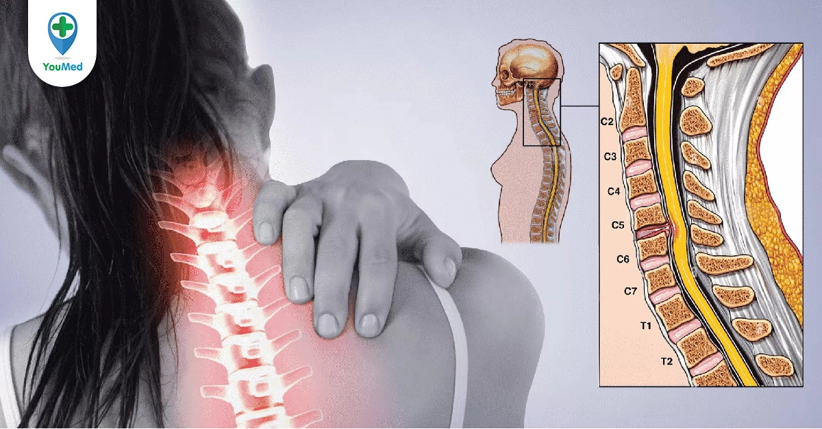 lộ trình ba bước chọn đệm phù hợp cột sống
