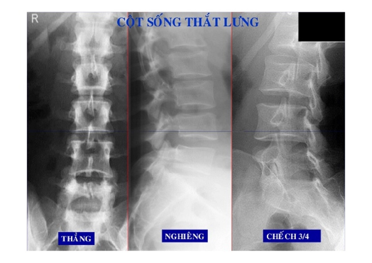 cột sống thẳng với tựa lưng nâng đỡ chuẩn